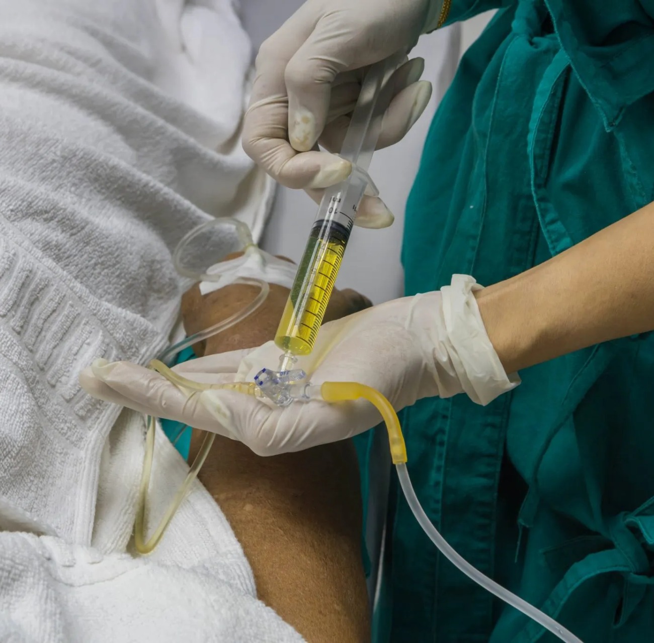 Paracentesis